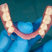 Full denture set ready for placement in Killeen 