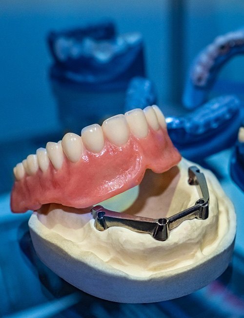 Happy Killeen patient enjoying confident smile