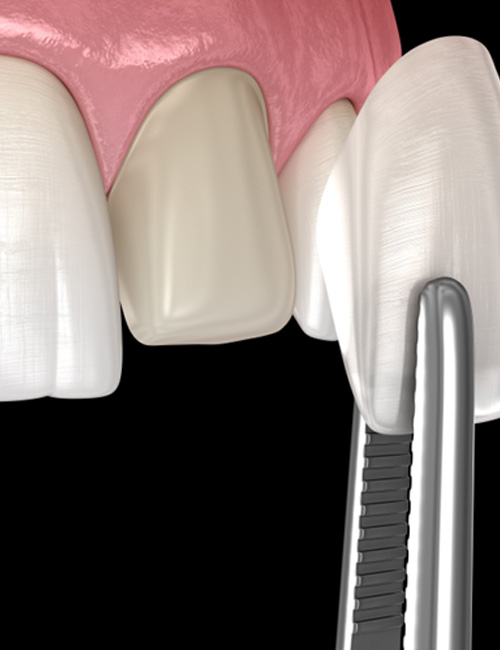 Up-close view of a dental 